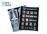 PET Base X Ray Sheet Film Chụp ảnh X-quang cho DR CT 100 Sheets mỗi gói