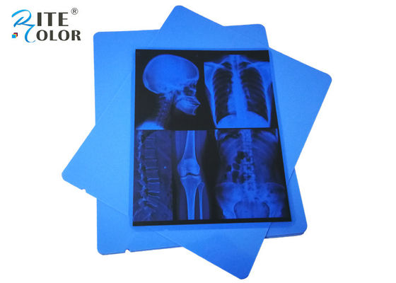 Phim hình ảnh y tế 13 X 17 inch PET X quang Xray Inkjet màu xanh lam