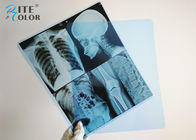 Inkjet Blue Radiology Film Imaging Film