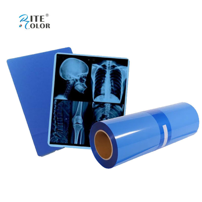 IMATEC Blue PET Inkjet Medical CR X-Ray Radiography Film Cho máy in Canon