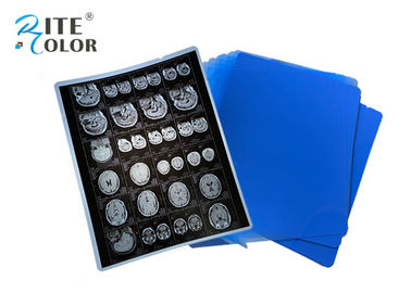 PET Base X Ray Sheet Film Chụp ảnh X-quang cho DR CT 100 Sheets mỗi gói