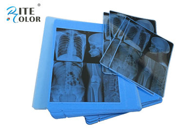 Phim chụp ảnh phóng xạ y tế Blue X Ray Độ dày 210um cho máy in phun Epson