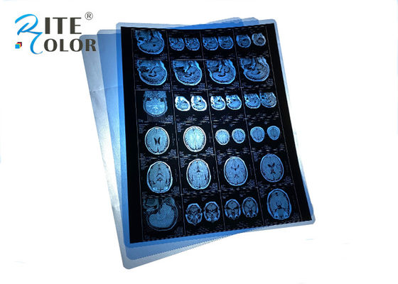 Bộ phim tia X quang y tế màu xanh PET chống nước cho MRI CT CR Tầm nhìn toàn cảnh răng